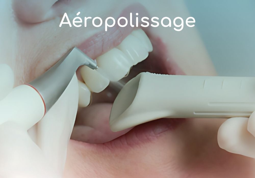 aeropolissage-cabinet-dentaire-idro-dentiste-sene