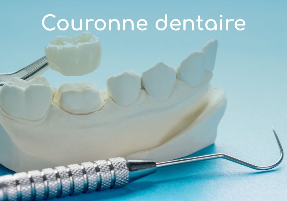 couronne-dentaire-dr-benoit-lenfant-vabinet-dentaire-idro-dentiste-sene