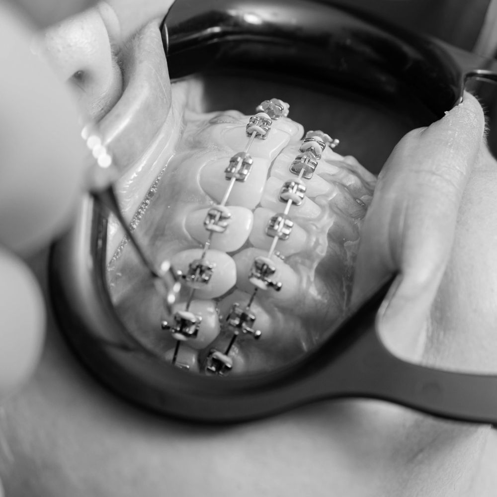 Orthodontie Sene