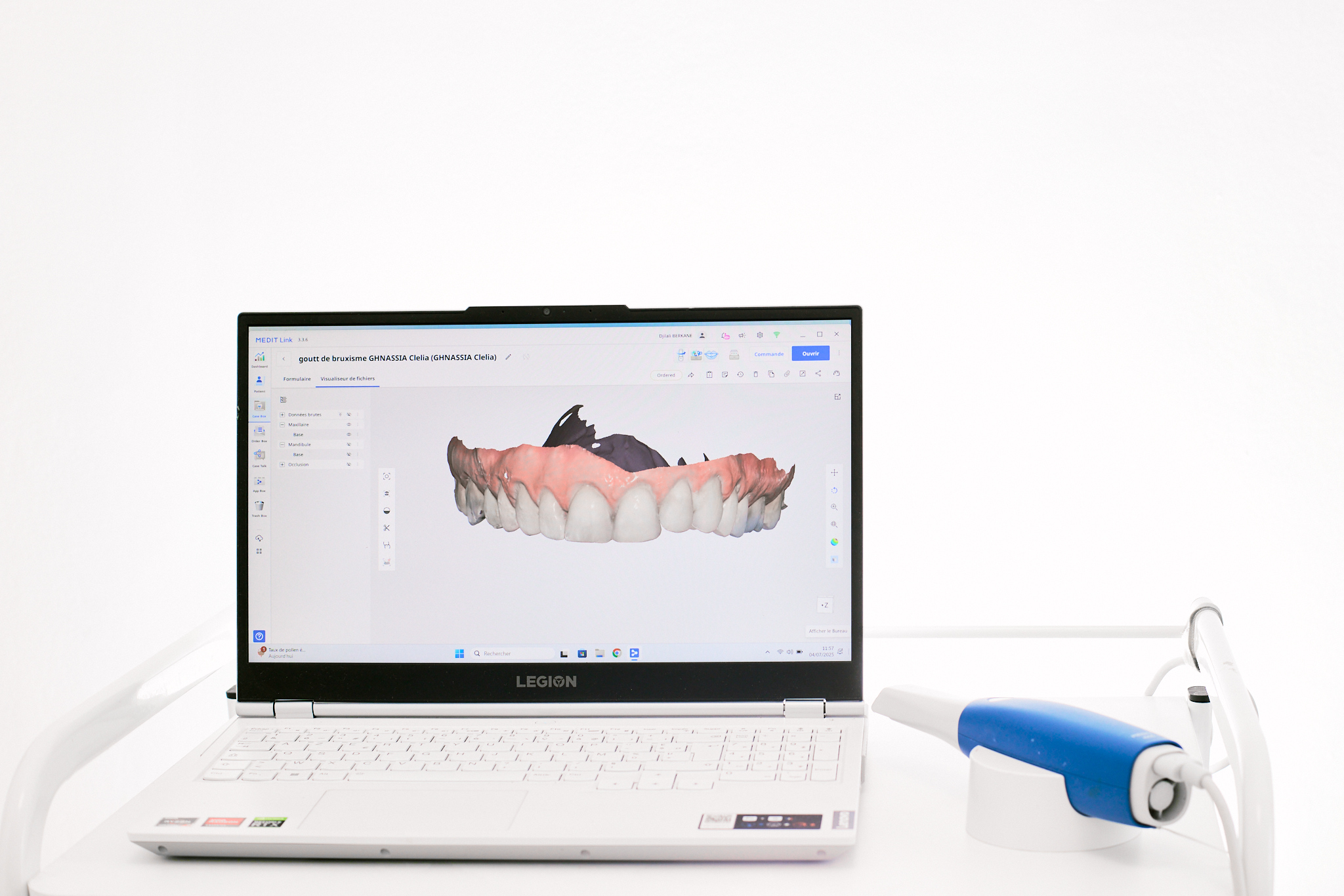 Esthétique dentaire Paris 14