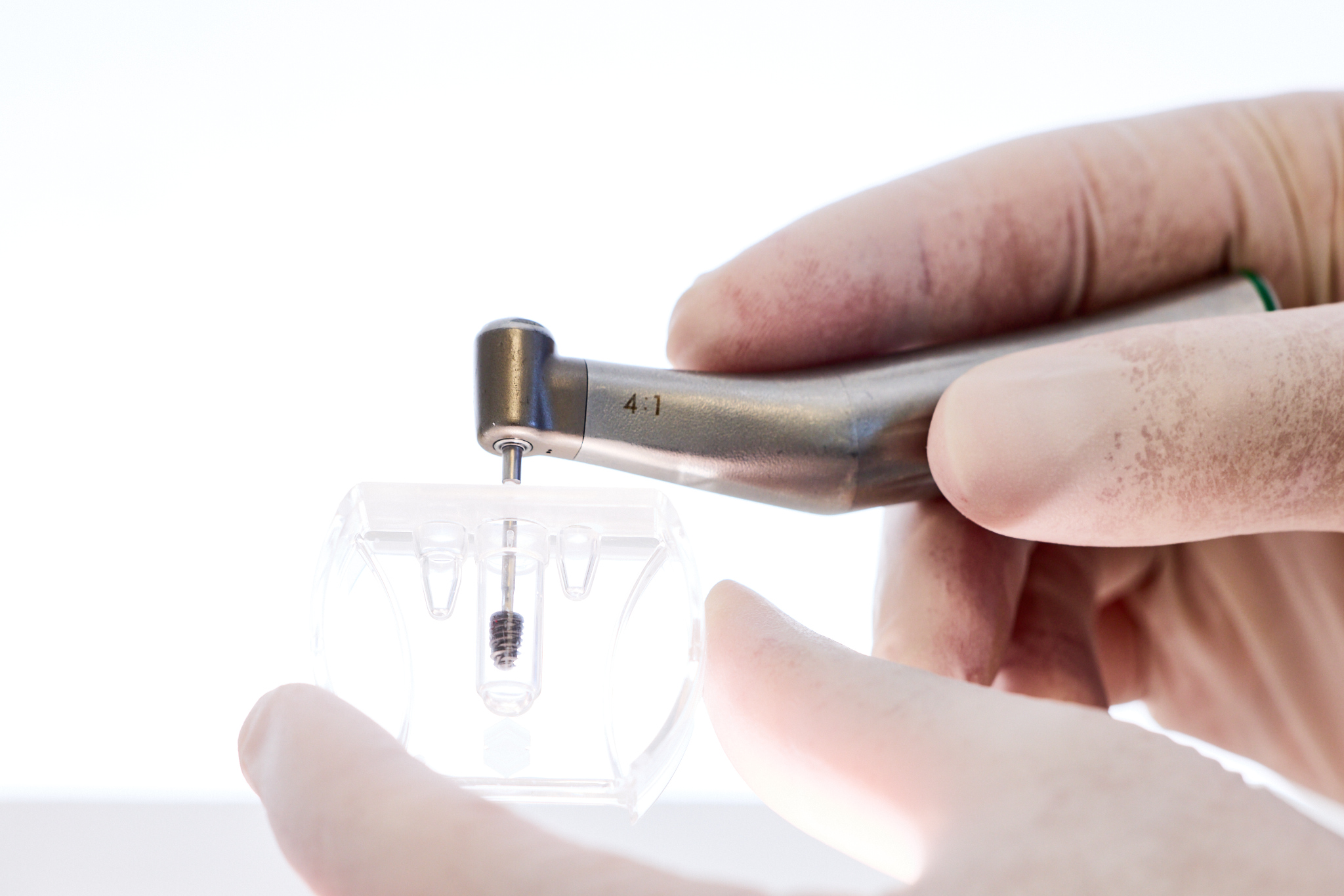 Implantologie Paris 14